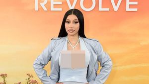 Foto: Gaya Cardi B di Coachella Viral Setelah Jalani Operasi Bokong