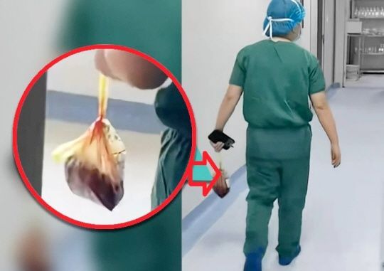 Duh! Resto China Ini Ketahuan Olah Plasenta Bayi Jadi Suplemen Kesehatan