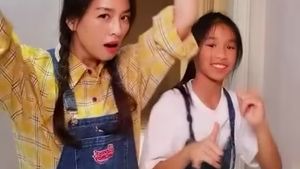Transformasi Remaja yang Dulu Diejek Anak Artis Terjelek, Kini Jadi Model