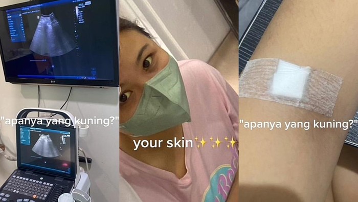 wanita di Tangsel kena gangguan liver