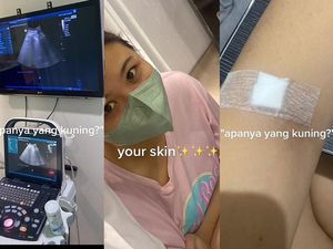 Awal Mula Wanita Tangsel Idap Gangguan Liver di Usia 21, Ini Gejala yang Dikeluhkan Awal Mula Wanita Tangsel Idap Gangguan Liver di Usia 21, Ini Gejala yang Dikeluhkan