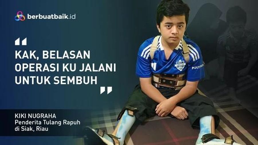 Alami Kerapuhan Tulang, Kiki Jalani 16 Kali Operasi Sejak Balita