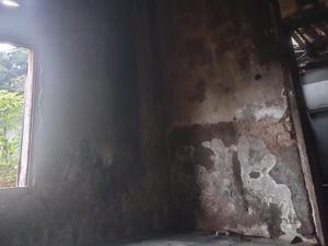Kaki dan Muka Ajat Luka Bakar Tersambar Api Gas Bocor Kaki dan Muka Ajat Luka Bakar Tersambar Api Gas Bocor