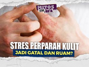 Video Mitos atau Fakta: Stres Tekanan Pekerjaan Memicu Eksim Kulit Lebih Parah Video Mitos atau Fakta: Stres Tekanan Pekerjaan Memicu Eksim Kulit Lebih Parah