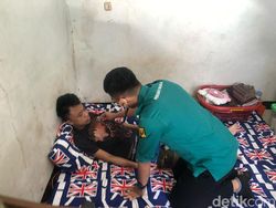 Pilu Abi, Remaja Sukabumi Terpaksa Putus Sekolah Usai Alami Penyakit Langka