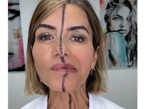 Dokter Ini Suntik Botox Hanya di Setengah Wajahnya, Hasilnya Mengejutkan