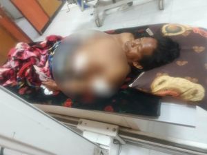 Pria di Dompu Nyaris Tewas Seusai Dibacok Sekelompok Orang Pria di Dompu Nyaris Tewas Seusai Dibacok Sekelompok Orang