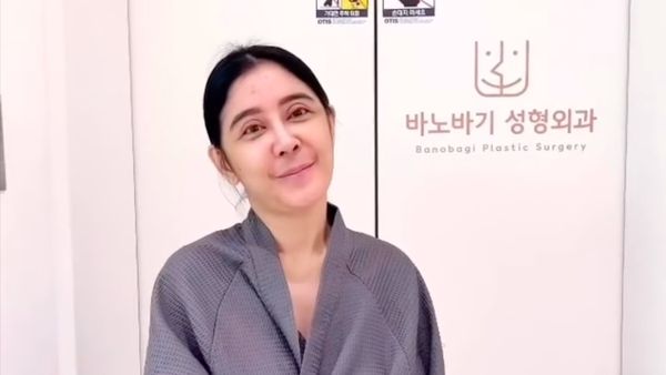 8 Foto Uut Permatasari Jalani Oplas di Korea, Begini Hasilnya