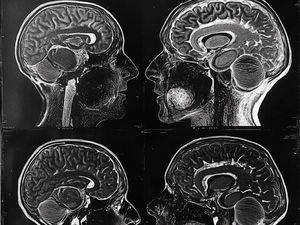 Cognitive Debt: Utang Kognitif, Akibat Otak yang Jarang Dipakai Cognitive Debt: Utang Kognitif, Akibat Otak yang Jarang Dipakai