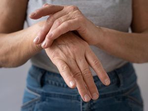 Kenapa Kulit Tangan Mengelupas? Ini Penyebab, Cara Mengatasi, dan Obatnya