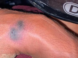 Waduh! Teknisi Internet Dipatuk Kobra Saat Pasang Tiang di Bayat Klaten