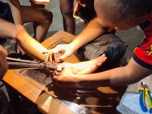 Bercanda Berujung Petaka, Kaki Remaja Indramayu Ini Terborgol