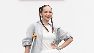 Enzy Storia Pakai Tongkat dan Kaki Digips, Kenapa Ya?