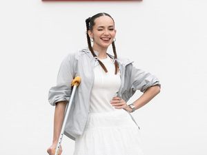 Enzy Storia Pakai Tongkat dan Kaki Digips, Kenapa Ya?