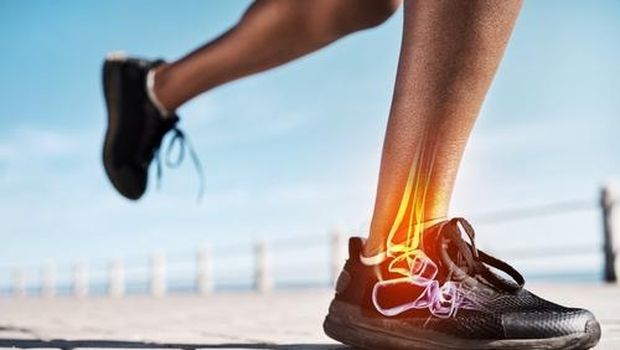 Ilustrasi cedera kaki akibat lari