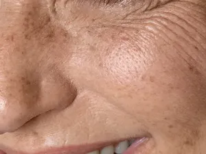 10 Tanda Kamu Mulai Menua, Semuanya Wajar