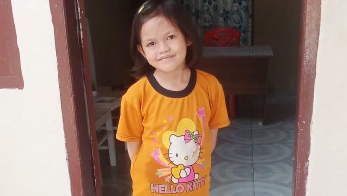 Putri Marwa Azzahra (8) didiagnosis dokter mengalami penyempitan usus. (Dok. berbuatbaik.id) Putri Marwa Azzahra (8) didiagnosis dokter mengalami penyempitan usus. (Dok. berbuatbaik.id)