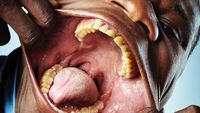 10 Orang dengan Tubuh yang Luar Biasa Unik