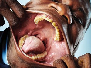 10 Orang dengan Tubuh yang Luar Biasa Unik