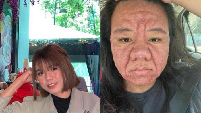 Wajah berganti di saat hamil Wajah berganti di saat hamil