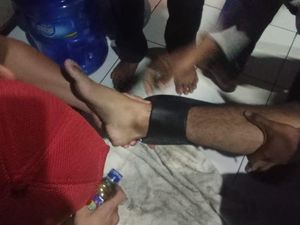 Sandal Nyangkut di Betis, Pemuda Ini Minta Bantuan Petugas Damkar Sandal Nyangkut di Betis, Pemuda Ini Minta Bantuan Petugas Damkar