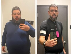 Pria di AS Sukses Pangkas BB 124 Kg Tanpa Operasi, Ini Rahasianya