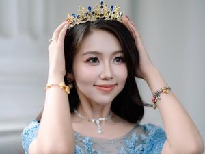 Sosok Vilmei Pacar Willie Salim, Punya 66 Juta Followers!