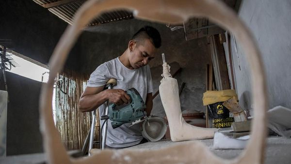 Kaki Palsu Buatan Lembang Beri Harapan bagi Penyandang Disabilitas