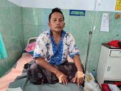 Cekcok di Warung Kopi, Kelingking Mbah Modin Rembang Putus Digigit Warga