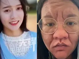 Viral Transformasi Wanita saat Hamil, Wajah Menggelap-Berkerut Bak Beda Orang Viral Transformasi Wanita saat Hamil, Wajah Menggelap-Berkerut Bak Beda Orang