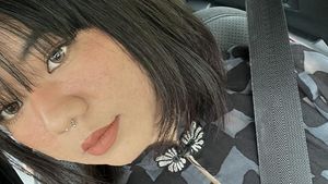 7 Foto Perubahan Wajah Wanita Ini saat Hamil Bikin Kaget: Berubah 100%