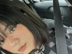 7 Foto Perubahan Wajah Wanita Ini saat Hamil Bikin Kaget: Berubah 100% 7 Foto Perubahan Wajah Wanita Ini saat Hamil Bikin Kaget: Berubah 100%