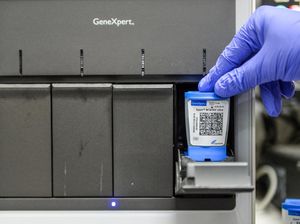 Penjelasan Pakar soal TB Laten, Kasusnya Lagi Meledak di Malaysia