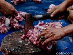 Kata Dokter soal Ciri-ciri Kolesterol Tinggi, Obesitas Lebih Berisiko