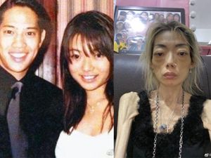 Kisah Pilu Model Hong Kong, Diet Ekstrem hingga Tinggal 22 Kg-Ditinggal Suami Kisah Pilu Model Hong Kong, Diet Ekstrem hingga Tinggal 22 Kg-Ditinggal Suami
