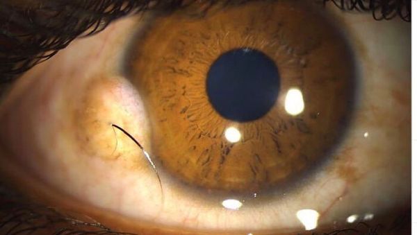 Kondisi Tubuh Manusia Ini Bikin Takjub dan Merinding