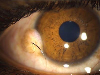 Kondisi Tubuh Manusia Ini Bikin Takjub dan Merinding