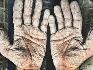 Asli! Ini Foto Kondisi Tubuh Manusia yang Bikin Merinding