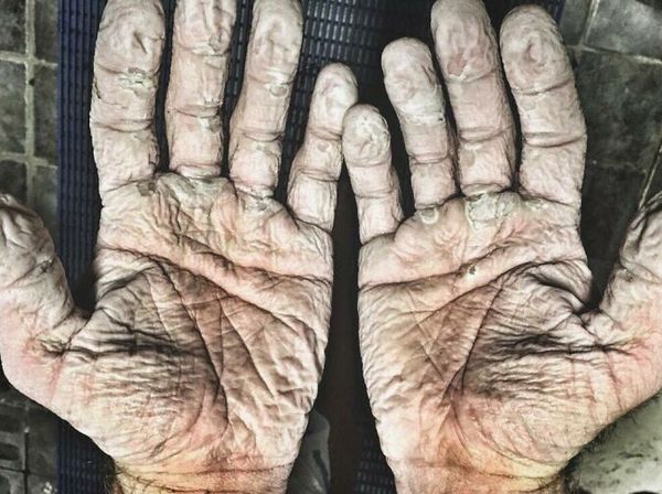 Asli! Ini Foto Kondisi Tubuh Manusia yang Bikin Merinding