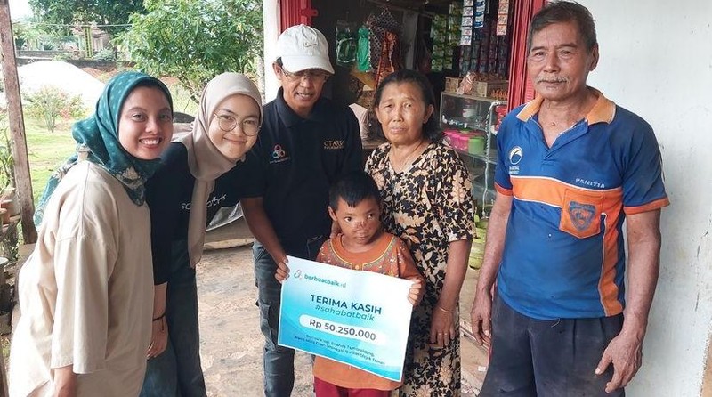 Sahabat Baik Bantu Sukseskan Operasi Tumor Hidung Dilan