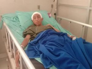 Luka Fatal di Kepala yang Bikin Remaja Cimahi Terbaring Tak Berdaya Luka Fatal di Kepala yang Bikin Remaja Cimahi Terbaring Tak Berdaya
