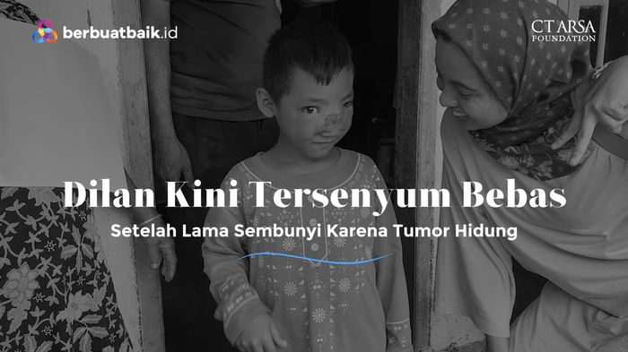 Semakin Riang, Semua Operasi Tumor Hidung Dilan Sukses