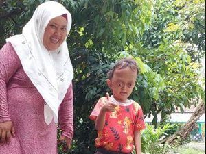 Kisah Si Kecil Aufan Derita Hidrosefalus, Crouzon Syndrome hingga Spina Bifida