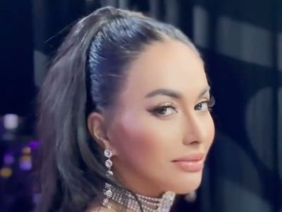7 Foto Denada Usai Jalani Oplas, Manglingi Dengan Hidung Mancung