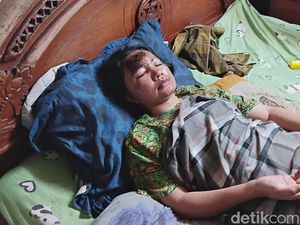 Pulang dari Mal, Ibu-Anak di Palembang Dijambret hingga Alami Luka Parah