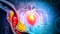 11 Tips Turunkan Kolesterol Tinggi agar Terhindar dari Pemicu Penyakit Serius