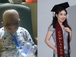 Kisah Inspiratif Michelle, Penyintas Kanker Darah yang Kini Jadi Psikolog