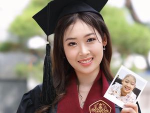 Perjalanan Michelle Penyintas Leukemia, Jalani Lebih 100 Kali Kemo untuk Sembuh Perjalanan Michelle Penyintas Leukemia, Jalani Lebih 100 Kali Kemo untuk Sembuh