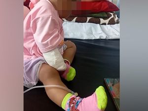 Video Nestapa Balita di Bima: Diduga Kena Malapraktik Berujung Tangan Diamputasi Video Nestapa Balita di Bima: Diduga Kena Malapraktik Berujung Tangan Diamputasi