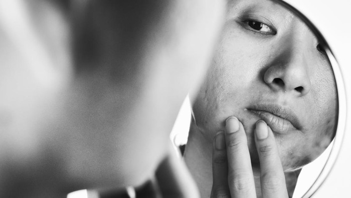 Skin problems and acne scar, Woman looking at mirror worried about her facial problem, Mirror reflection, Beauty concept.